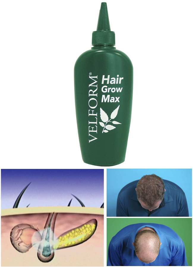 Körperpflege & Kosmetik - «VELFORM Hair Grow Max» Haarwasser, in Farbe  Ansicht 1